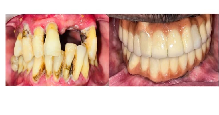 Patient Before and After Transformation